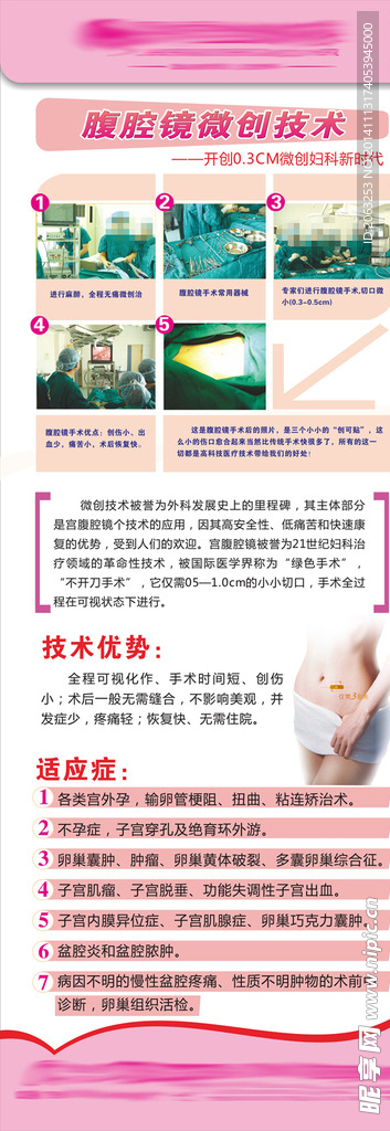 腔镜微创宣传