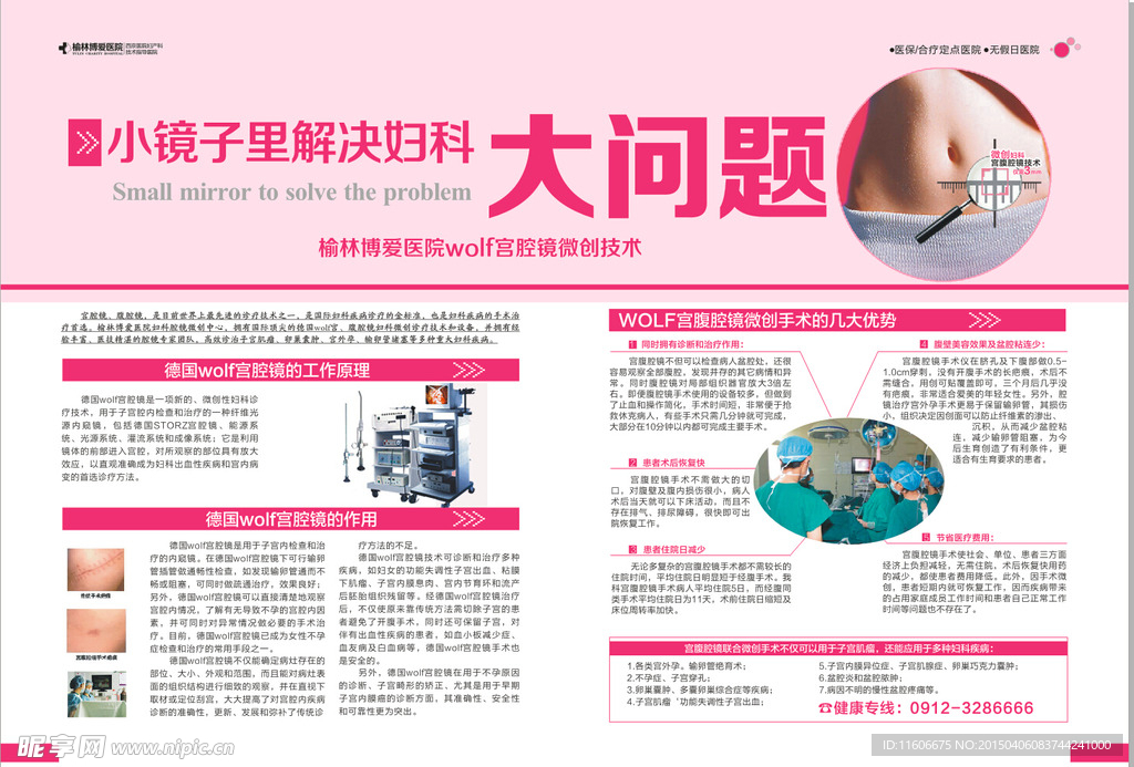 妇科宫腹腔镜微创不开刀杂志彩页