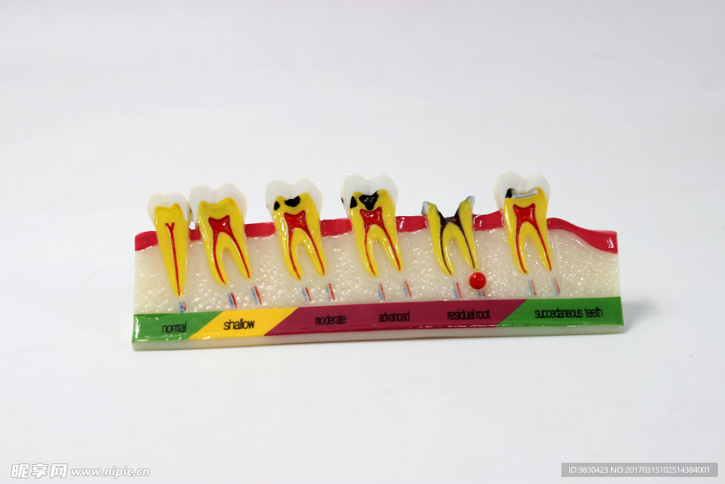 牙齿模型
