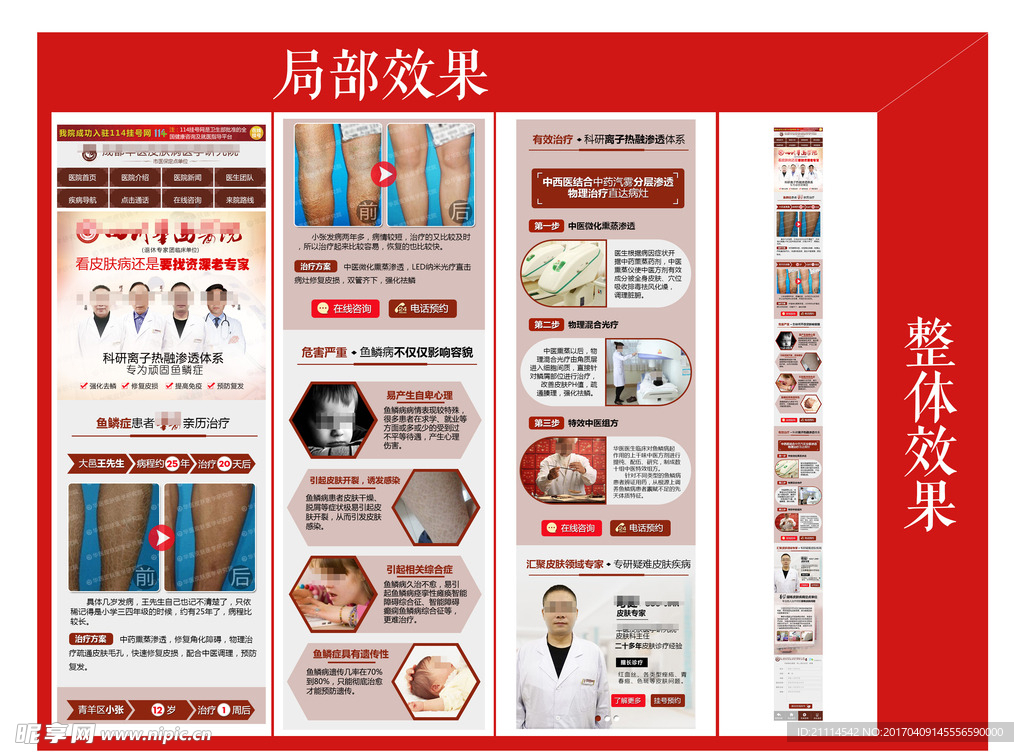 鱼鳞症专题图片 皮肤病医院专题