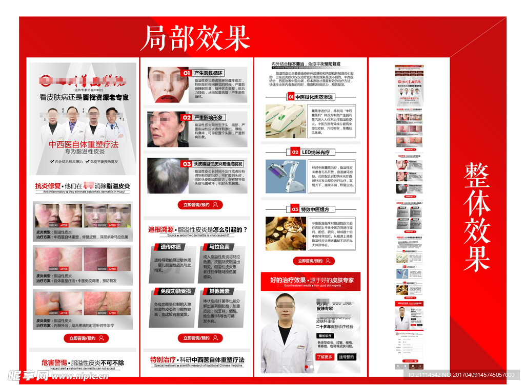 脂溢性皮炎专题图 过敏 皮肤病