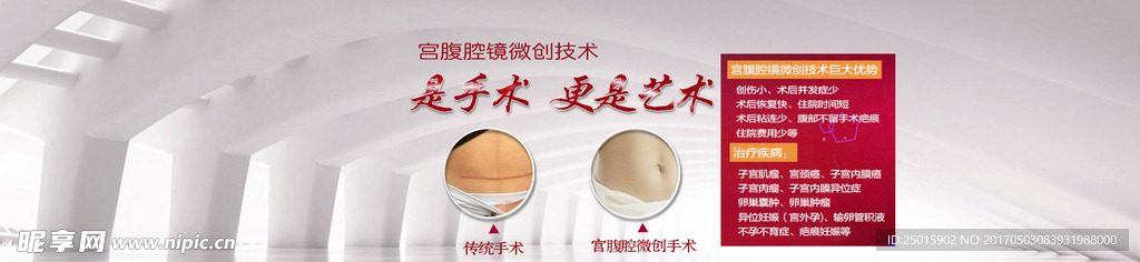 妇科宫腹腔镜微创技术网页广告