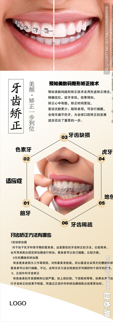 口腔牙齿矫正展架