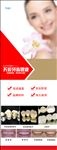 口腔烤瓷牙展架