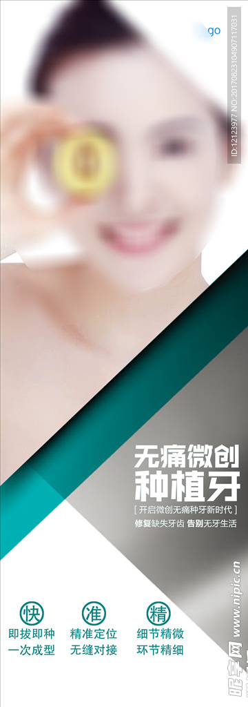 口腔种植易拉宝