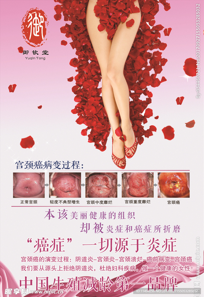 宫颈癌海报