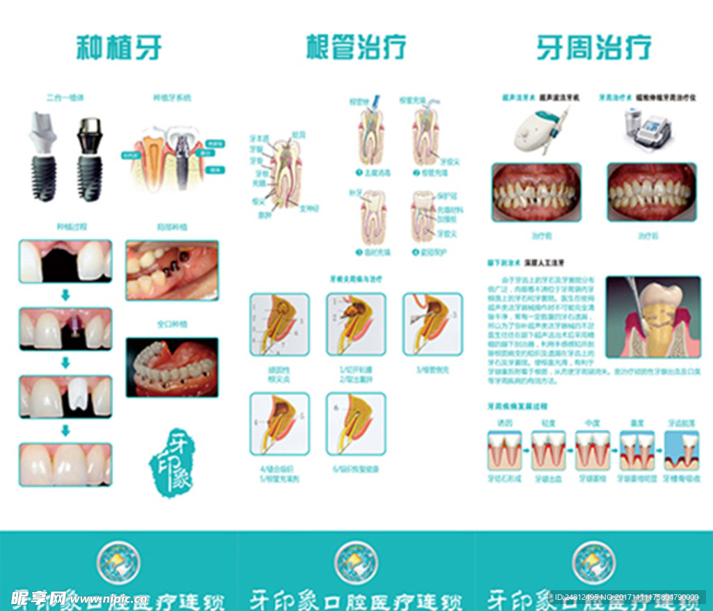 牙印象口腔知识宣传展架