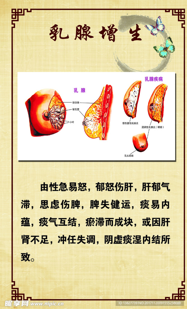 乳腺增生 乳房疼痛  关爱乳房