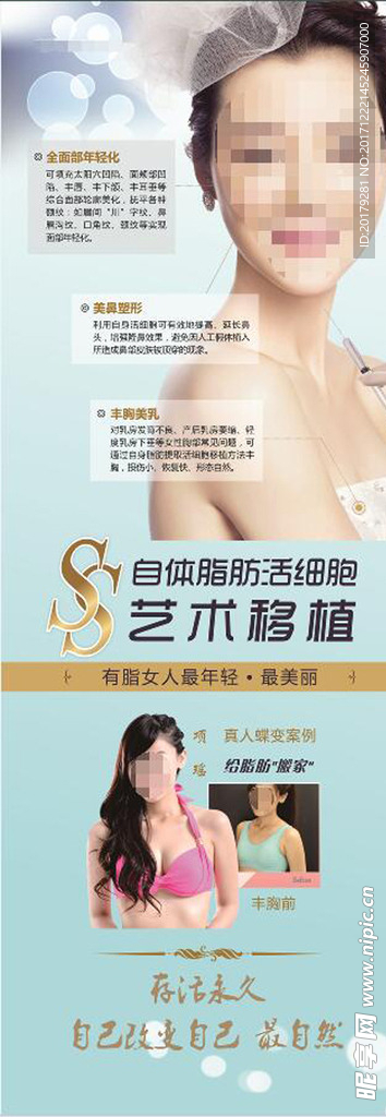 自体脂肪活细胞移植