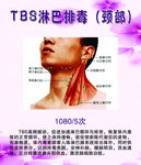 TBS淋巴排毒
