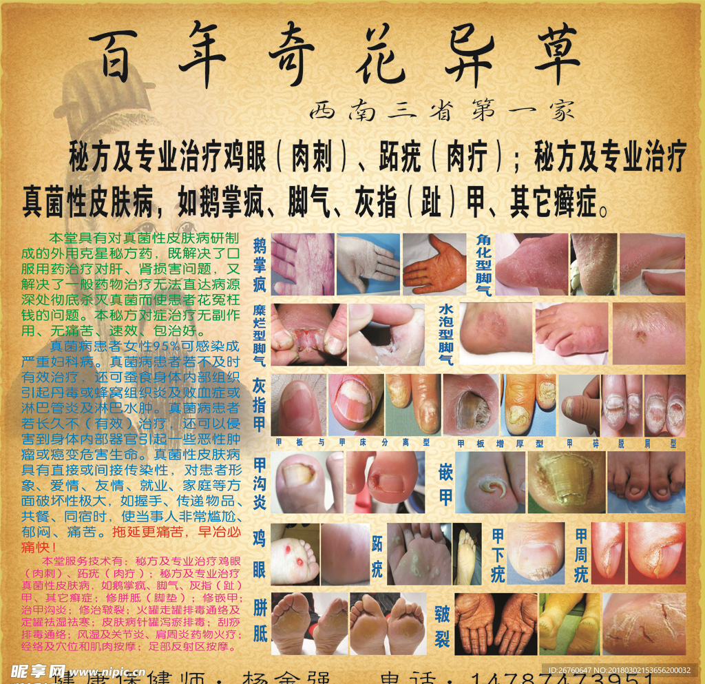 百年奇花异草灰指甲