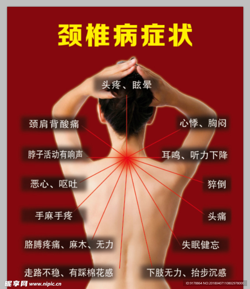 颈椎病症状 海报