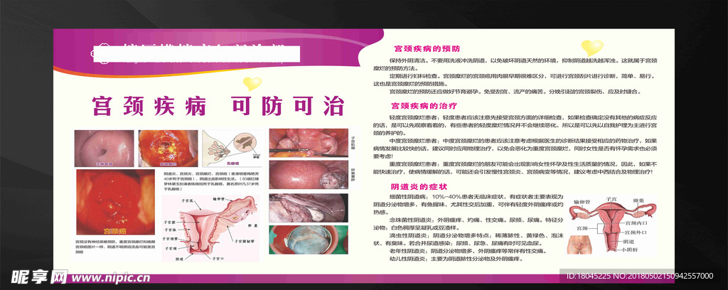宫颈展板