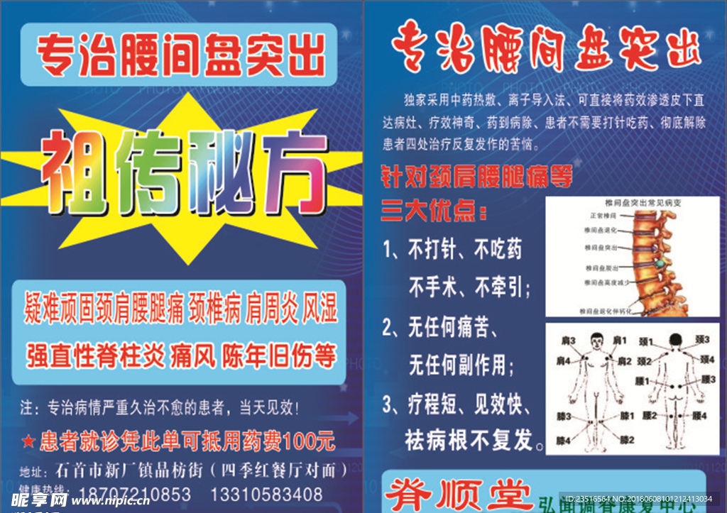 腰间盘突出宣传单