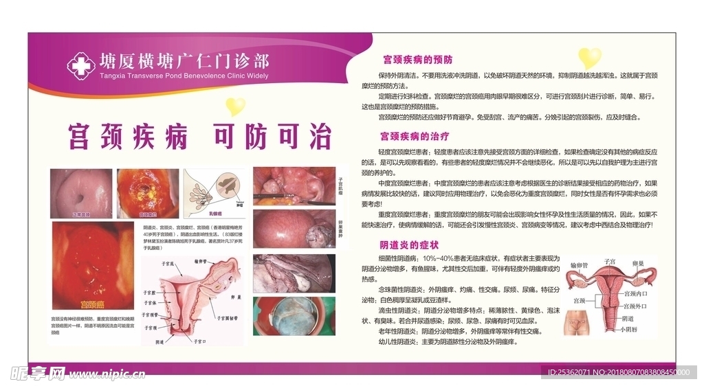 妇科病展板