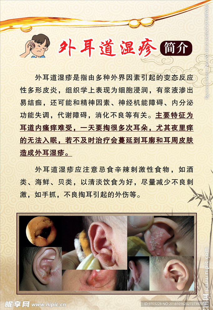 外耳道湿疹简介