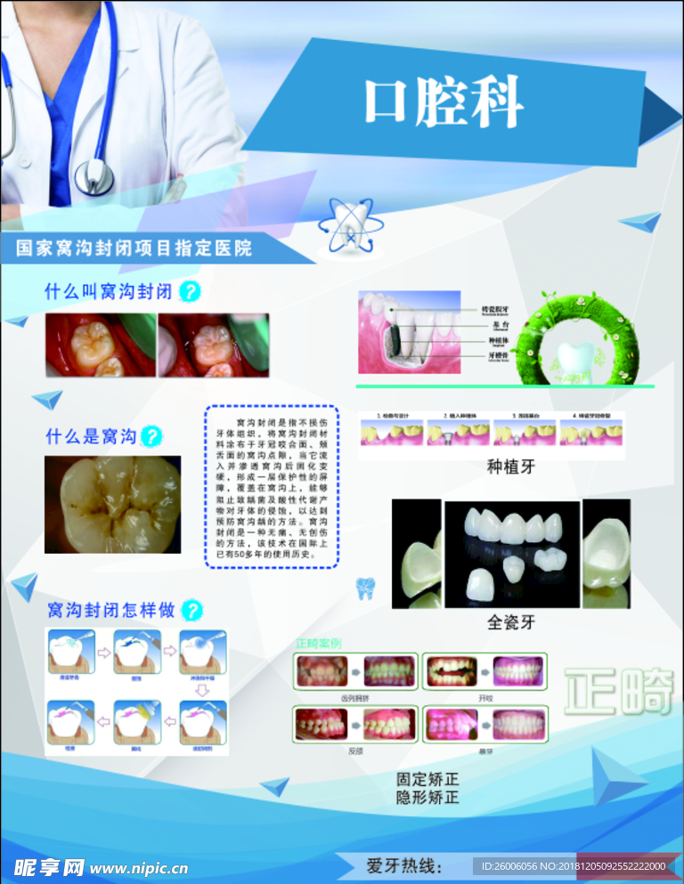 口腔科窝沟封闭