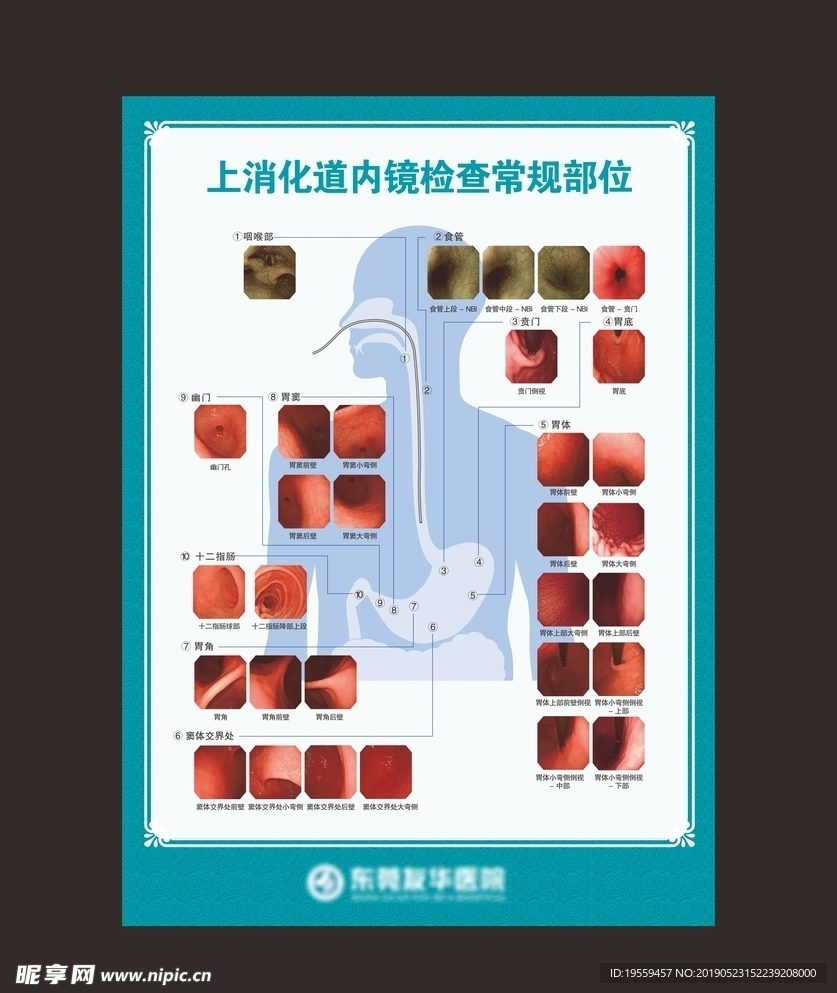 科室挂图胃镜