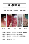 出痧颜色