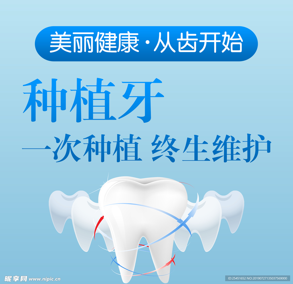 种植牙