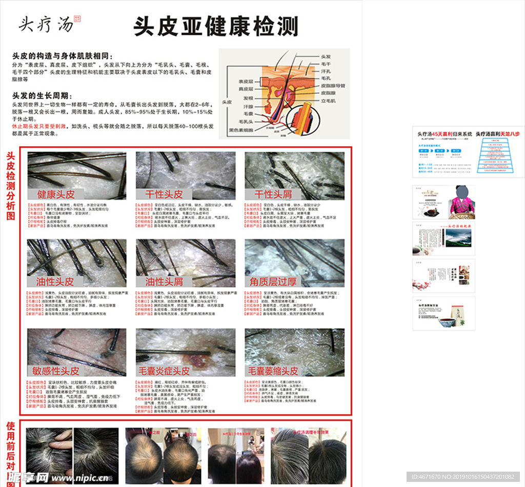 头疗汤  美容养生  宣传海报