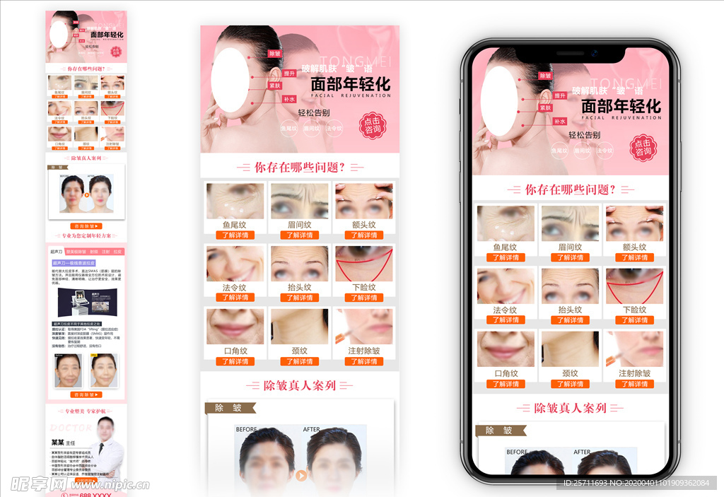 面部年轻化 详情页