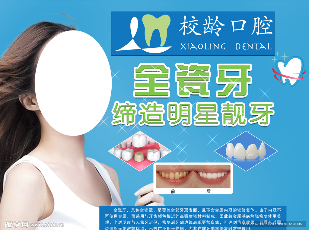 全瓷牙贴图片