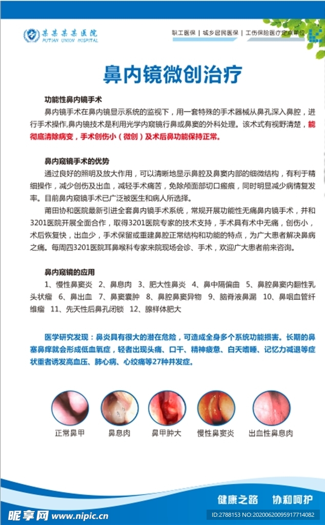 鼻内窥镜耳鼻咽喉科