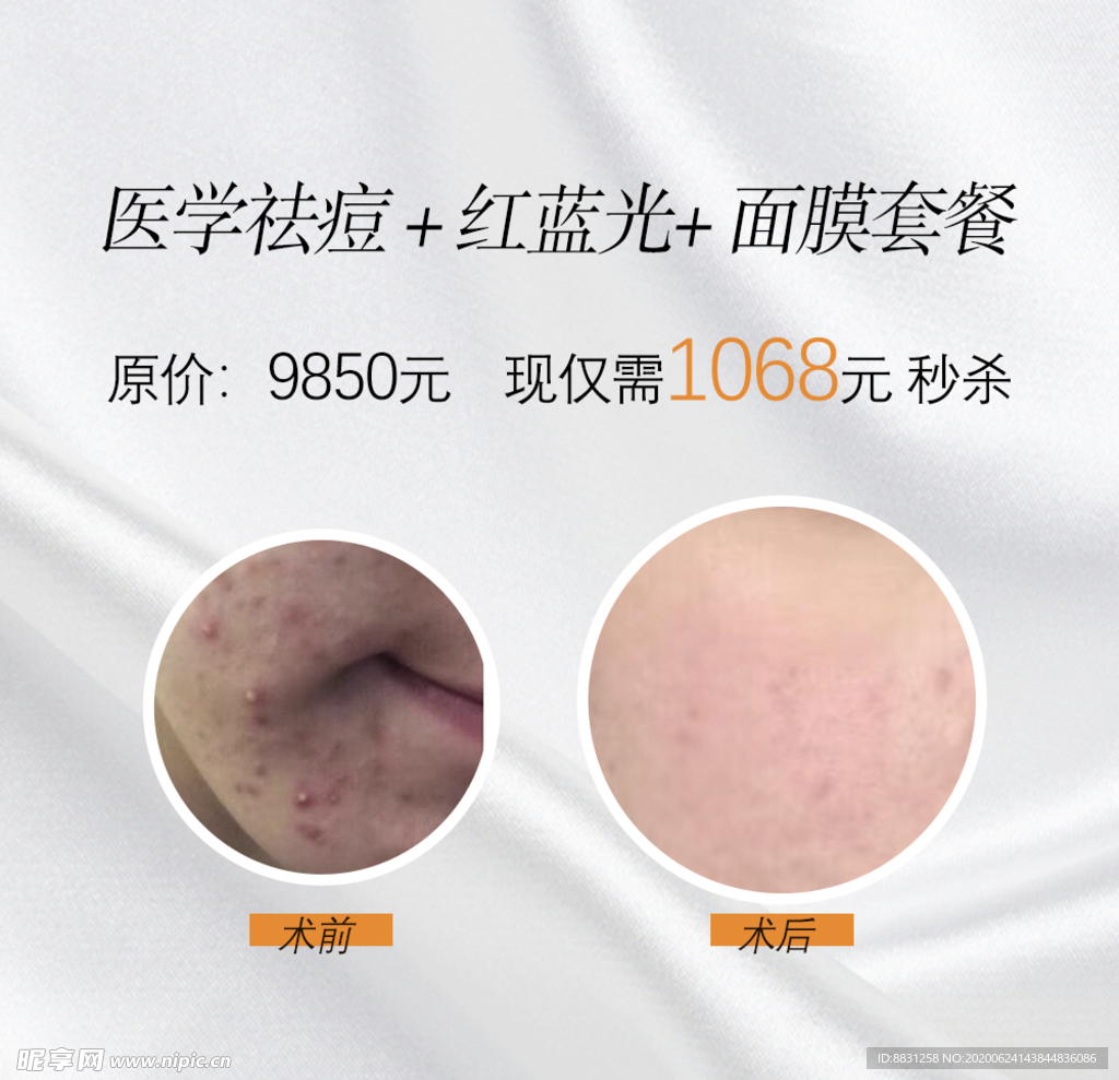 祛痘 去痘 去青春痘 祛青春痘