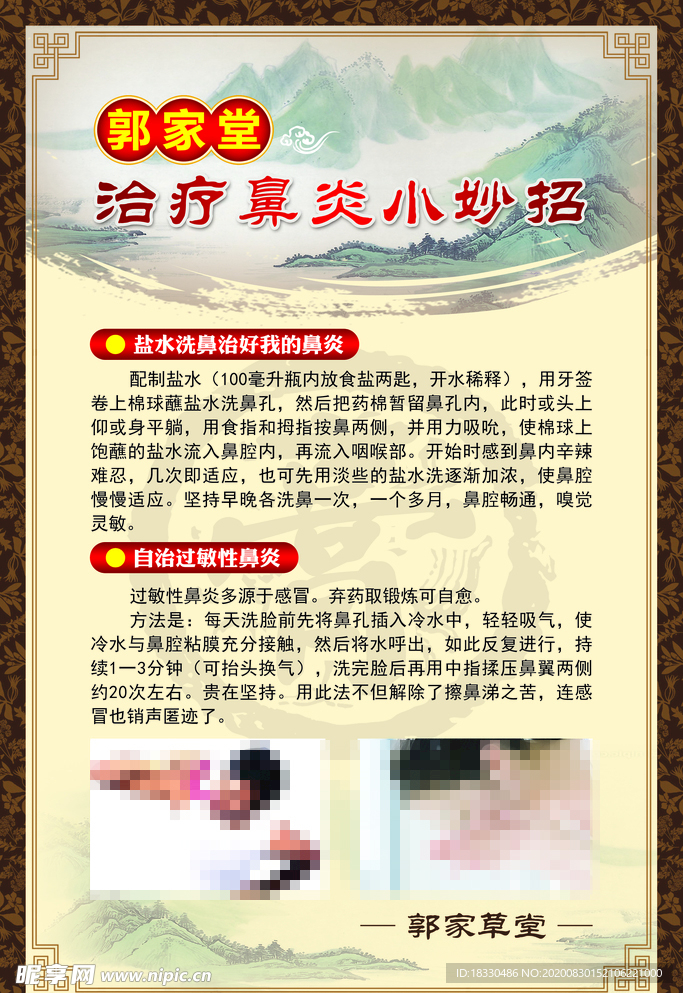 治疗鼻炎展板