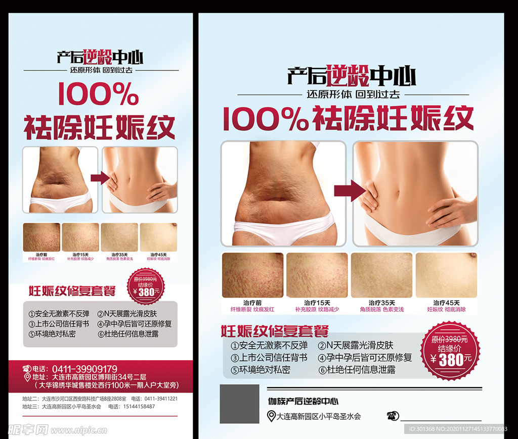 祛除妊娠纹海报