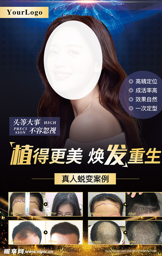 植发海报图片