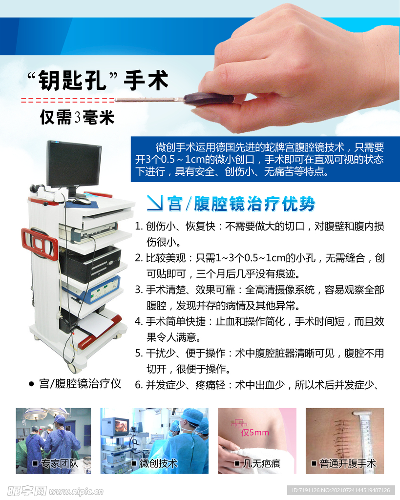 钥匙孔手术宫腹腔镜治疗优势