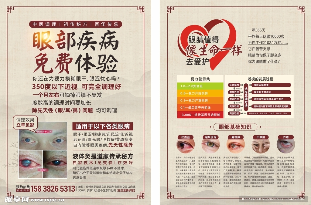 眼病单页    免费体验单页