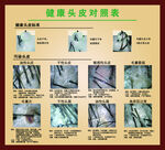 健康头皮对照表