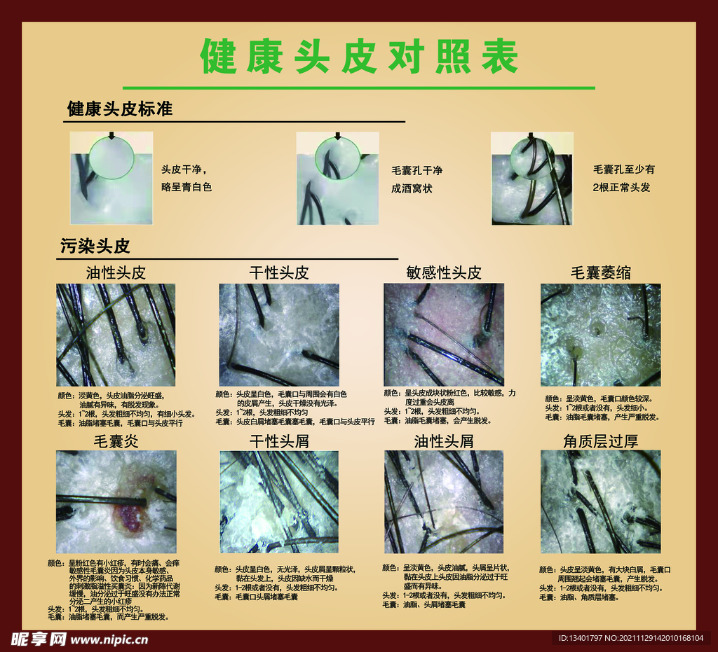 健康头皮对照表