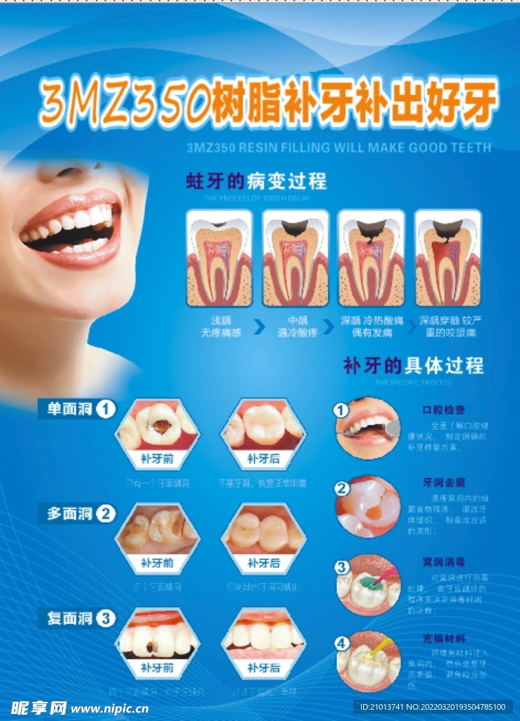 补牙海报