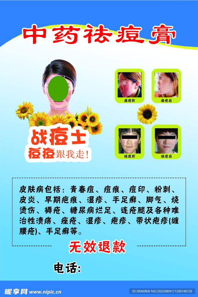 中药祛痘海报