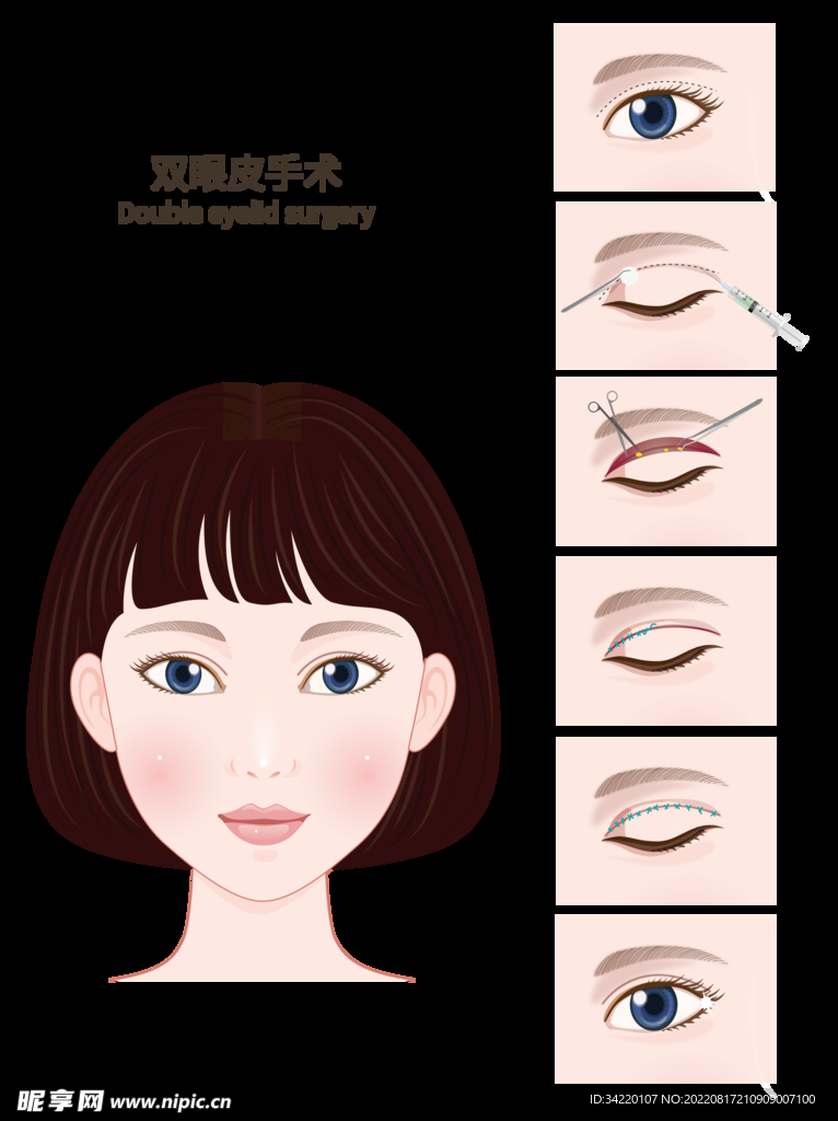 医疗美容双眼皮手术插图素材