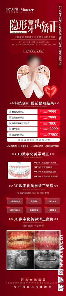 口腔隐形矫正科普