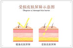 受损皮肤屏障示意图