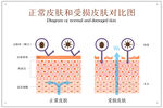 正常皮肤和受损皮肤对比图