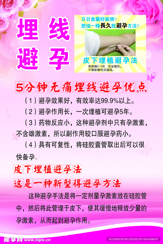 埋线避孕产后修复护理保健调理