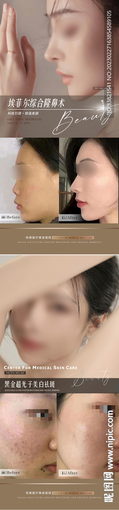 医美案例对比海报