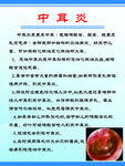 中耳炎  内含7个文件