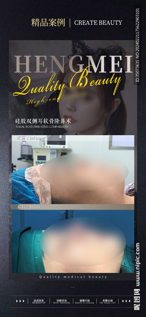 医美整形耳软骨隆鼻  