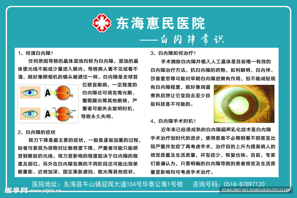 惠明医院  白内障 眼科 眼球