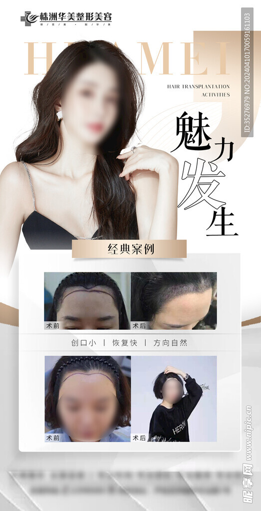 魅力发生案例对比