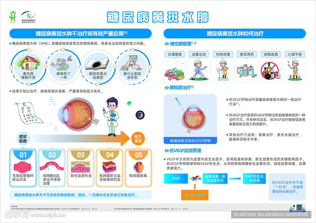 糖尿病黄斑水肿