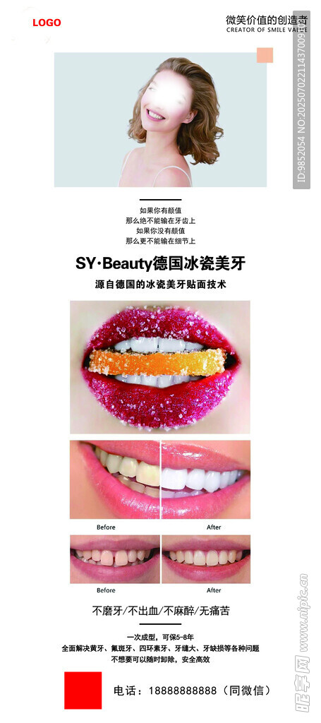 牙齿矫正前后对比展示